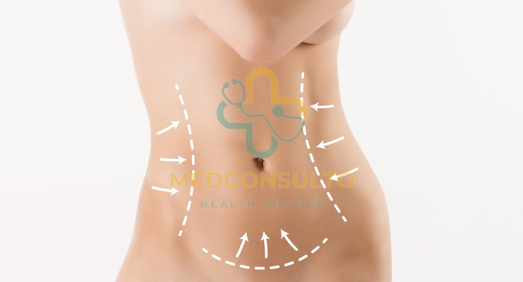 Vaser Liposuction