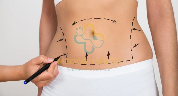 Tumescent liposuction vs traditional Liposuction