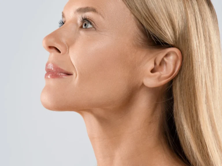 Chin Liposuction