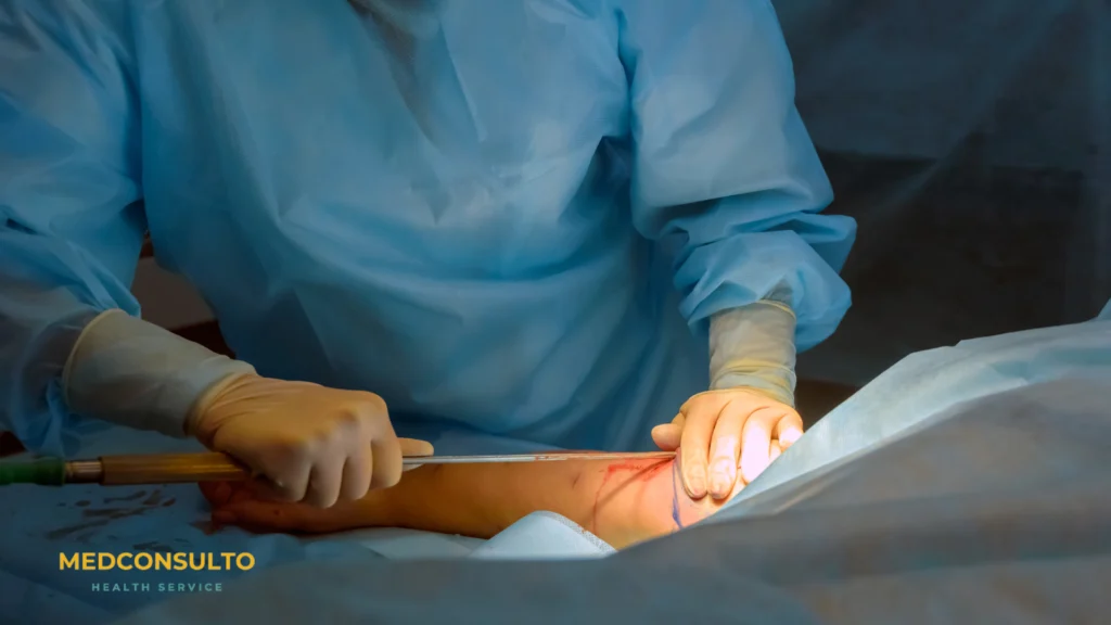 Doctor performing Upper Arm Liposuction Procedure