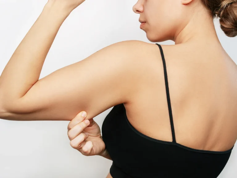 arm liposuction surgery