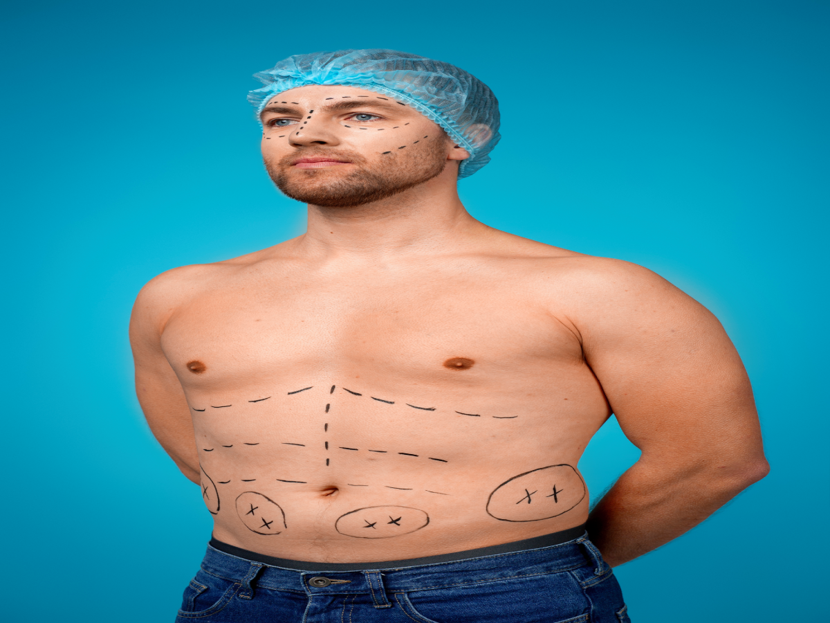 Liposuction for Men: all you need to know