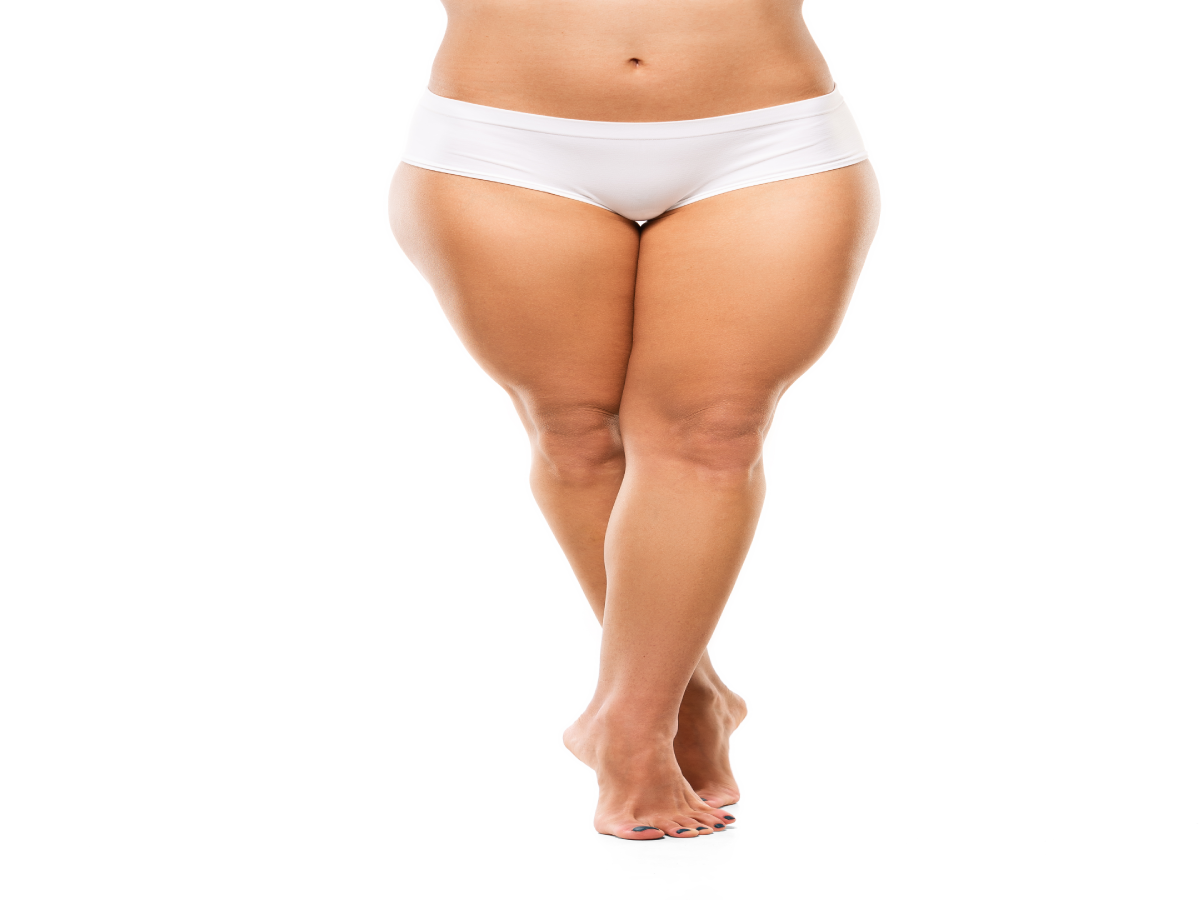 Discover Thigh Liposuction Costs