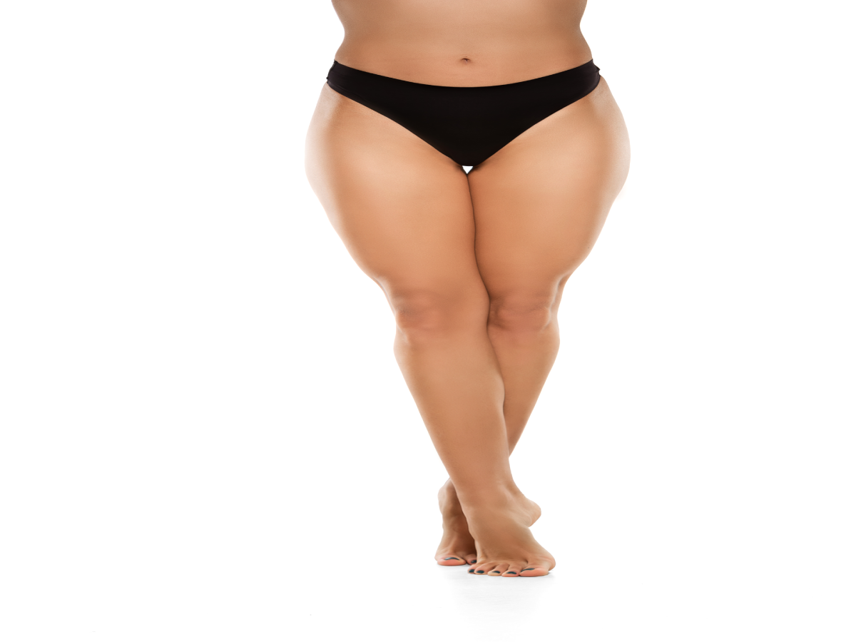 thigh liposuction in turkey