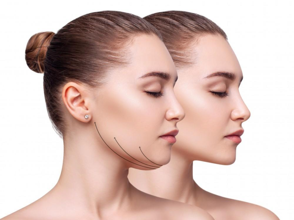 What is kybella and how does it work?