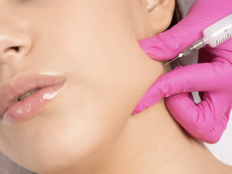 What's special about Kybella treatment in Turkey?