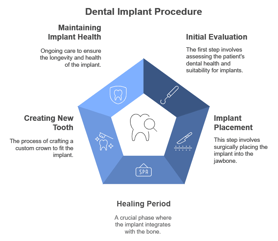 What are the steps of dental implantation?