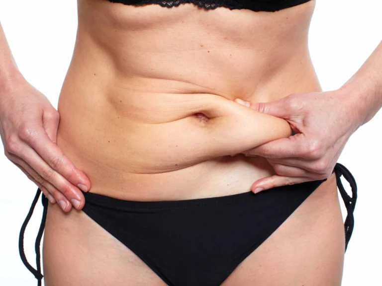 all you need to know about Stomach Liposuction