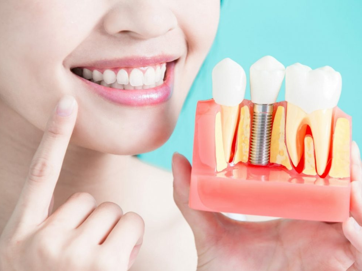 Woman smiling and pointing at a dental implant model, illustrating the benefits of dental implants for tooth replacement and oral health