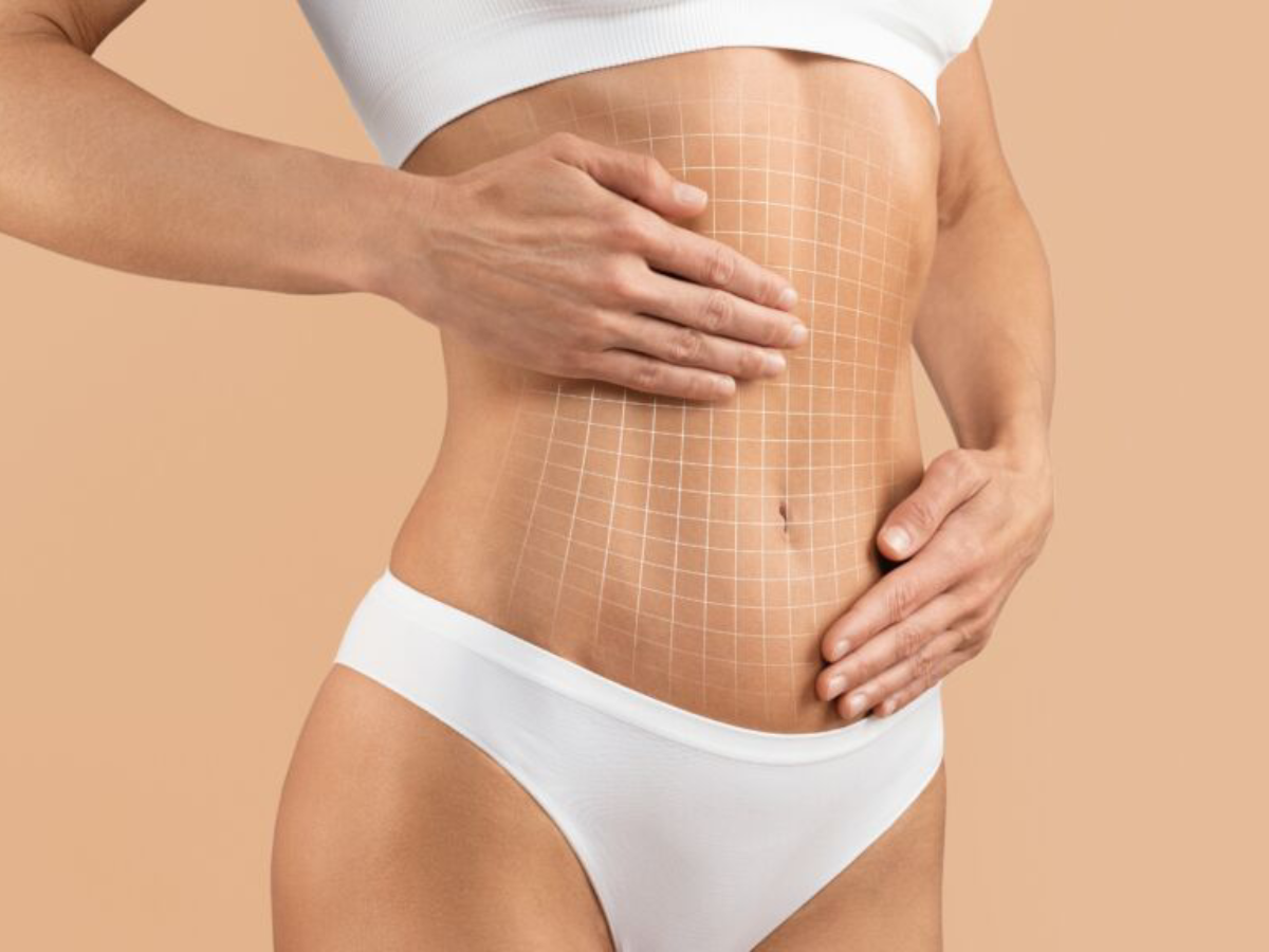 Tummy Tuck Surgery in Turkey