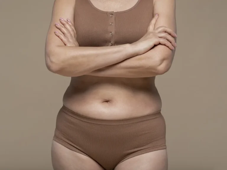 Bad Tummy Tuck